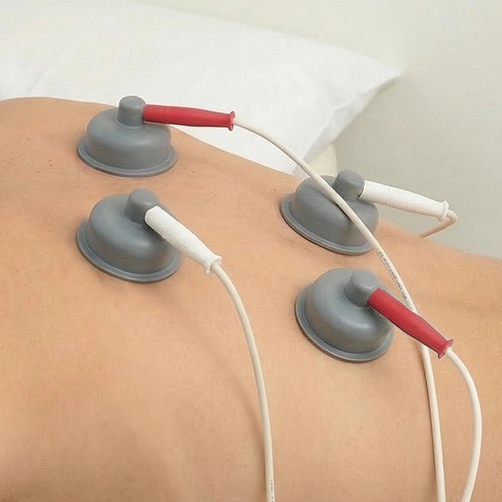 Plynové injekce pro úlevu od bolestí    